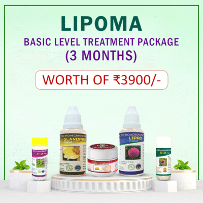 Lipoma Treatment Plan