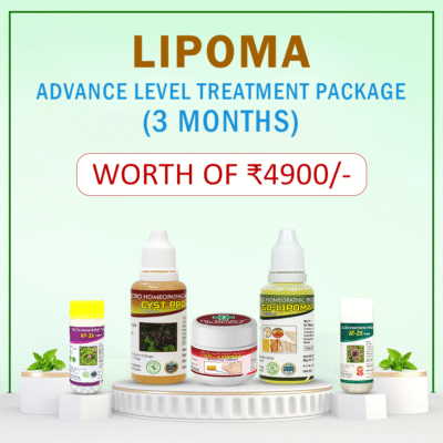 Lipoma Treatment Plan